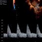 Linee guida pratiche ISUOG: uso dell'ecografia Doppler in ostetricia