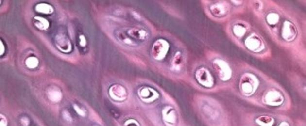 Hur nervvävnad ser ut i mikroskop.  Hjärnan under mikroskopet